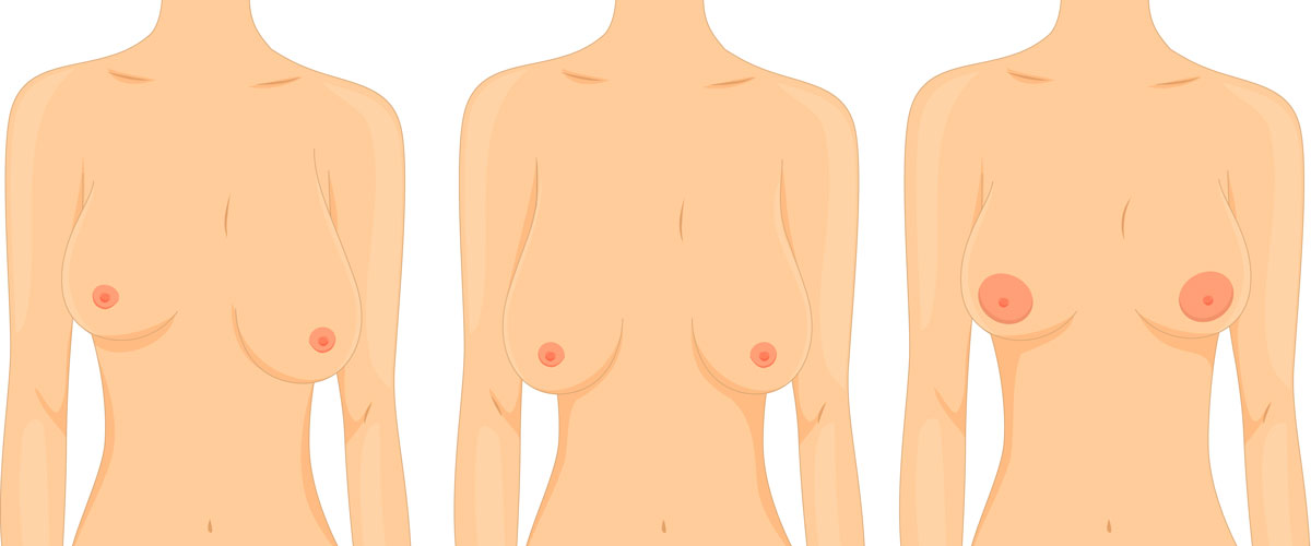 Breast-Augmentation-Five-things-you-must-know-before-undergoing-surgery-from-Price-to-post-operation-recovery-time-121615-03