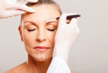 Face Lift/Rhytidectomy: What's Involved