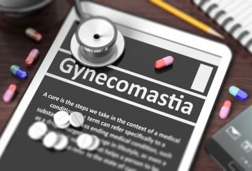 Gynecomastia: An Overview