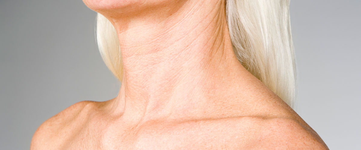 Neck-Lift-121615-02