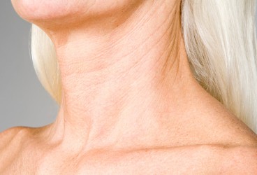 Neck Lift Costs: Your Comprehensive List