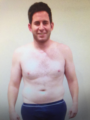 Tarek El Moussa after his iodine treatment and 3 months of limited movement post back surgery.