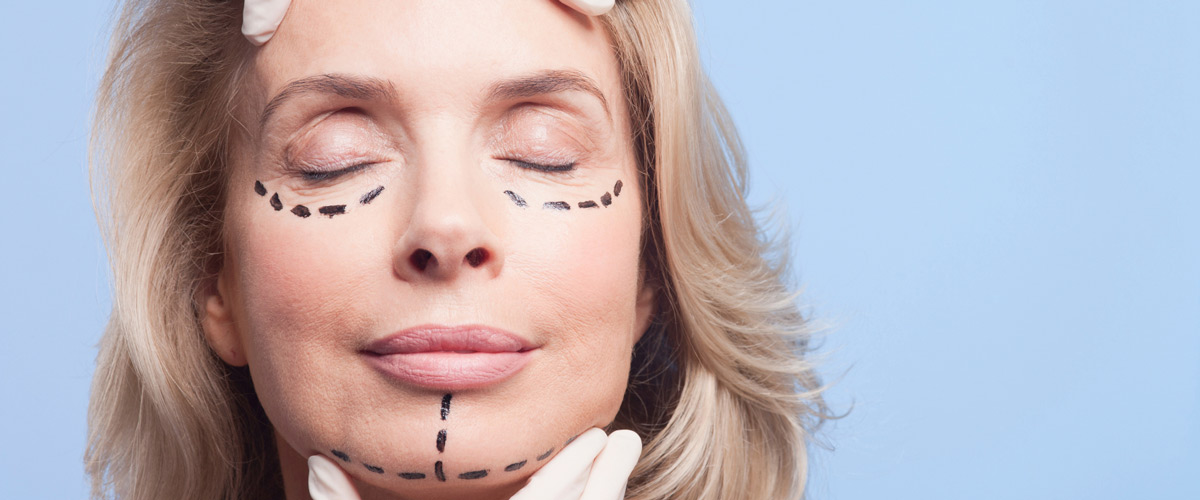 Your-Face-Lift-The-Recovery-is-Real