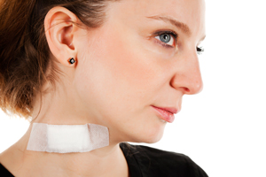 neck-lift-recovery-4