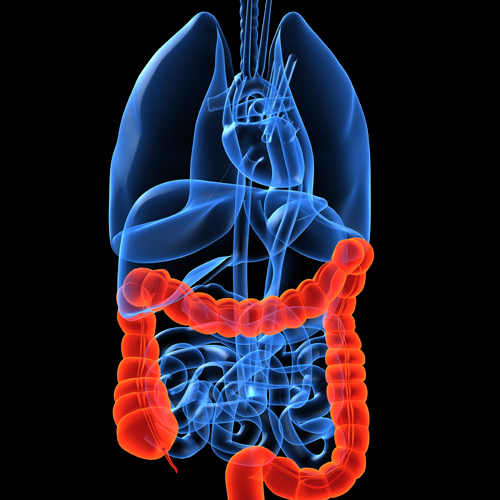 Dr-Nik-Sekhar-on-Colon-Cancer-2