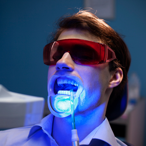 Teeth-Whitening-3